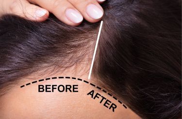 A woman 's head with a before and after picture of her hair.