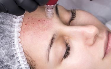 A woman is getting a treatment on her face.