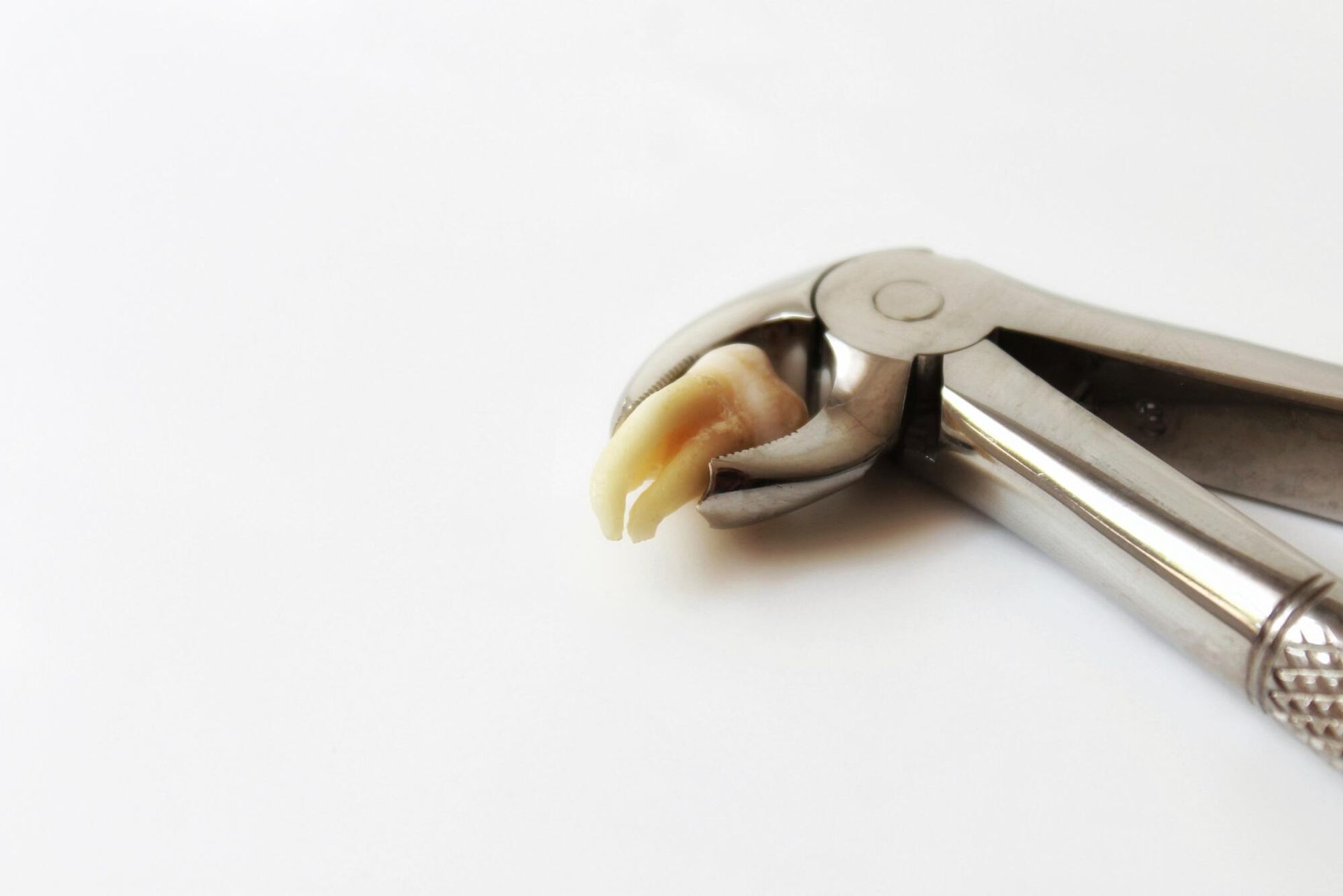 A tooth being held in a dental forceps on a white background