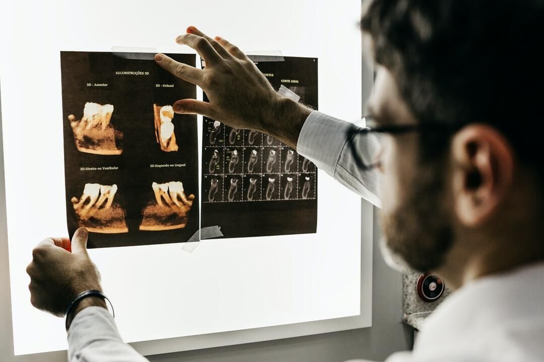 A dentist is looking at an x-ray of a patient 's teeth.