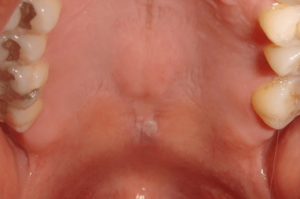 Pathology TERSA Oral & Facial Surgery