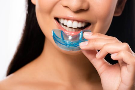 A person smiling while holding a blue, clear plastic dental appliance up to their mouth.