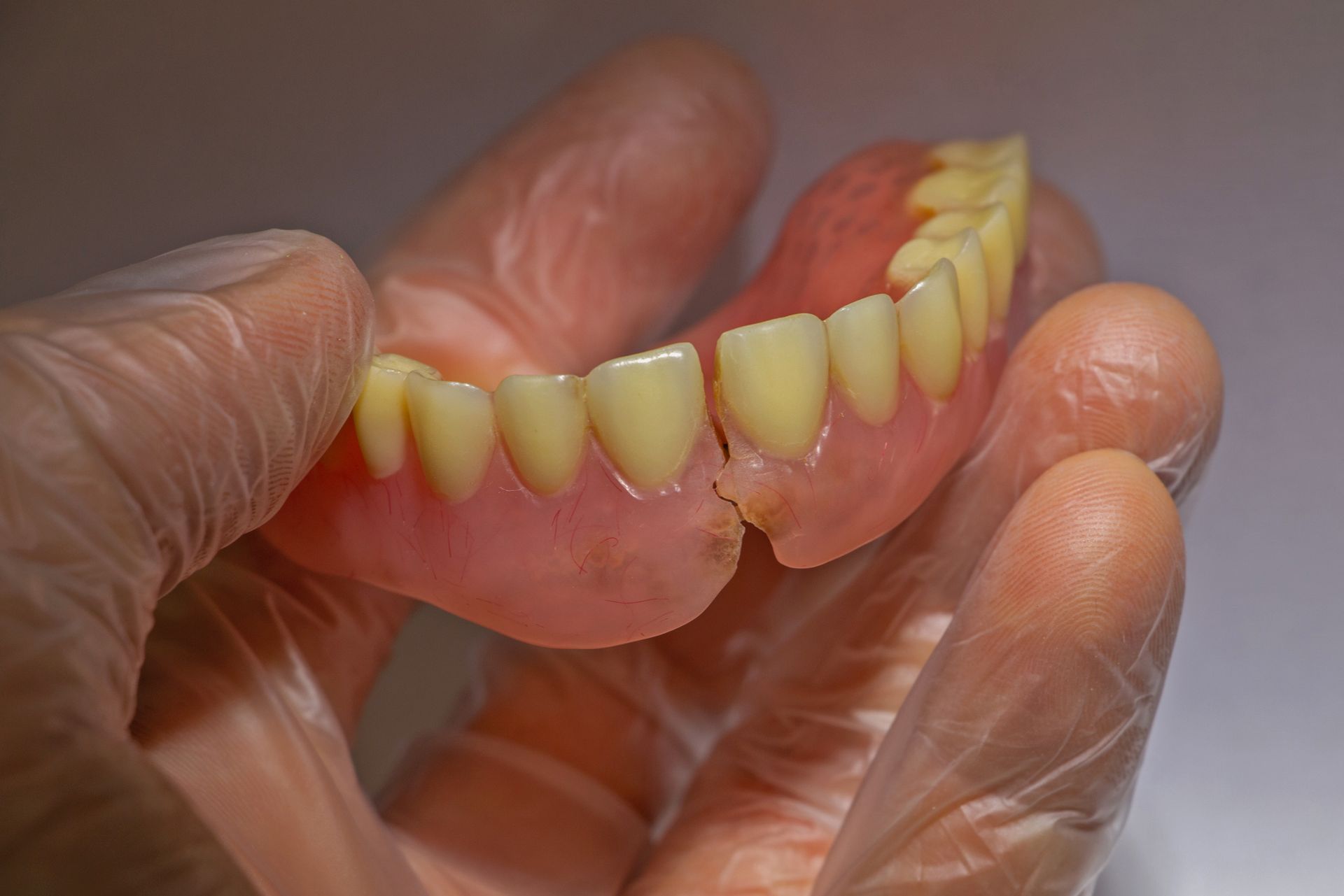 A person wearing clear plastic gloves holds a broken, pink acrylic dental denture.