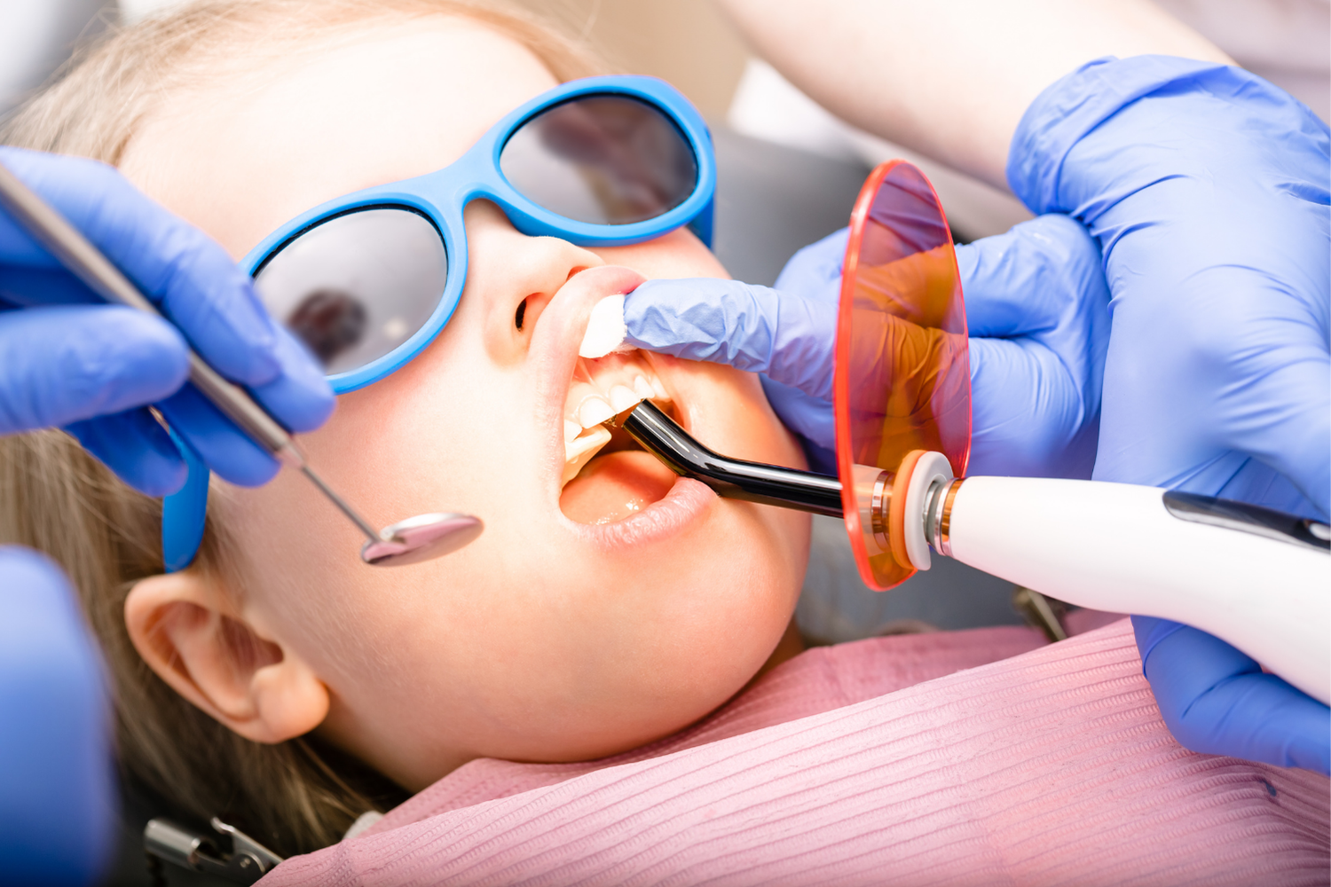 A dentist wearing blue gloves uses a dental curing light and mirror to treat a patient’s teeth.