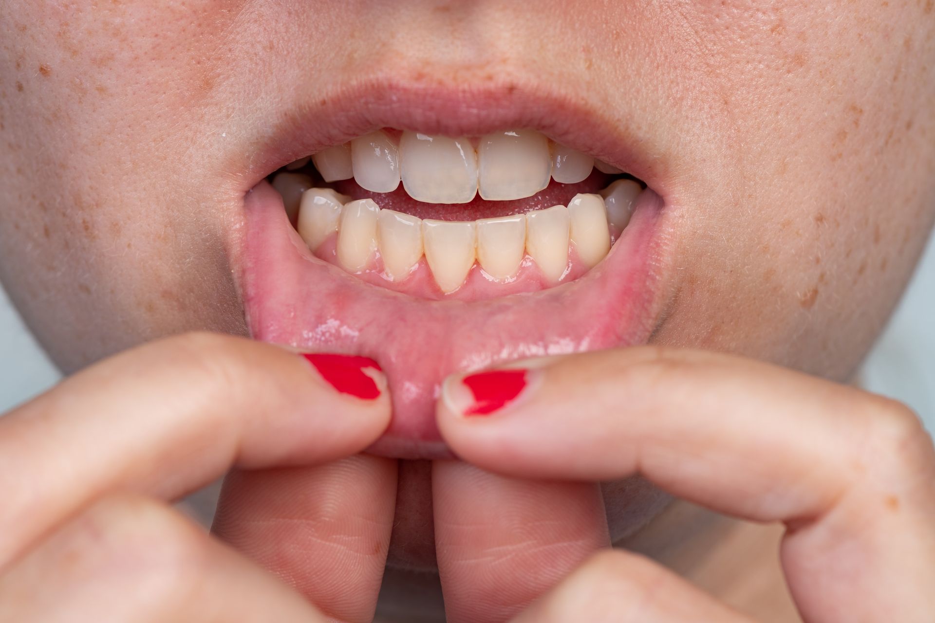 A person pulling down their lower lip to reveal their gums and lower teeth.