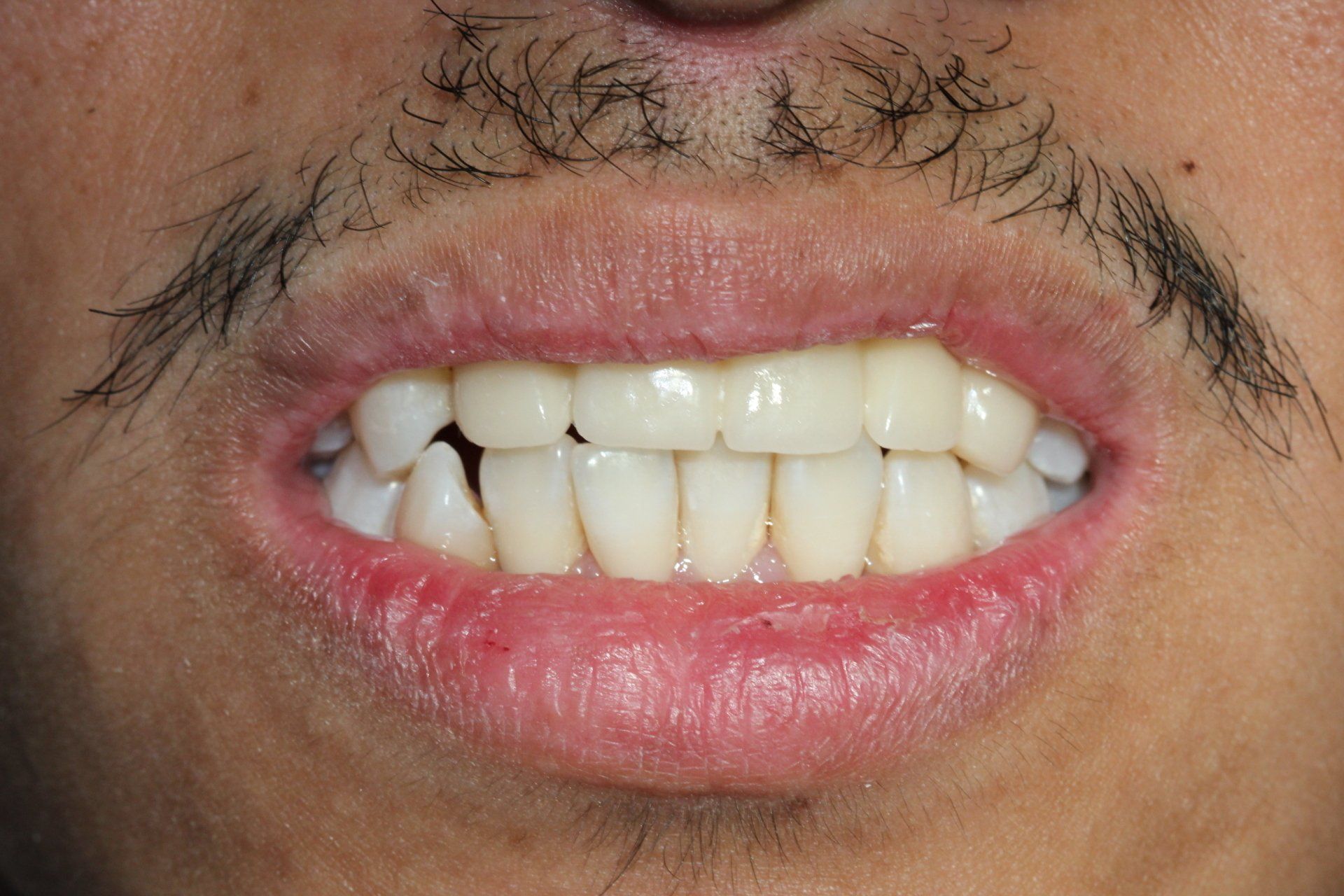 Family Dentist Stockton CA Stockton Dentists DDS California