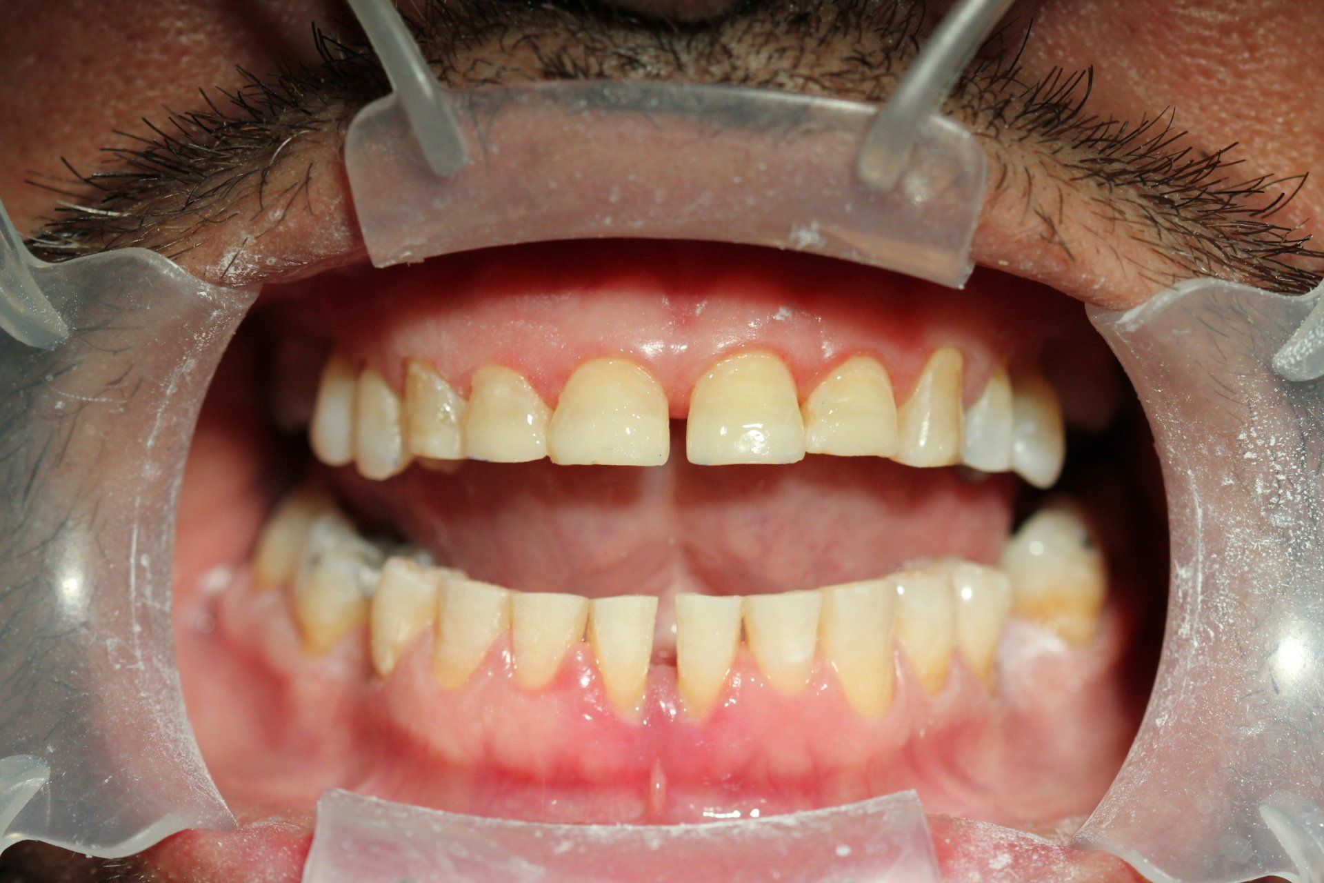 Family Dentist Stockton CA Stockton Dentists DDS California