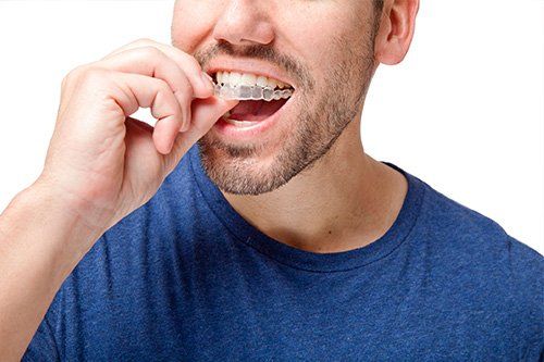 Teeth Straightening patient at Galvez Dentistry