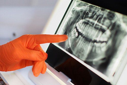 dental X- Rays Galvez Dental