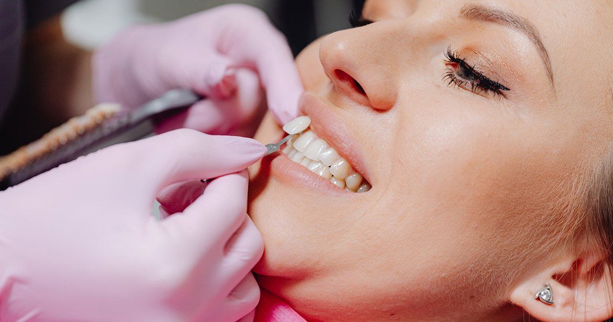 chipped tooth repair after - Wake Orthodontics & Pediatric Dentistry