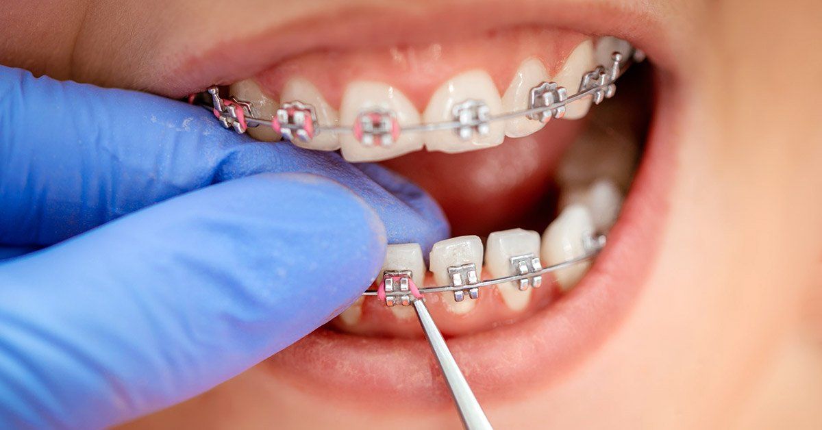 seek orthodontic treatment