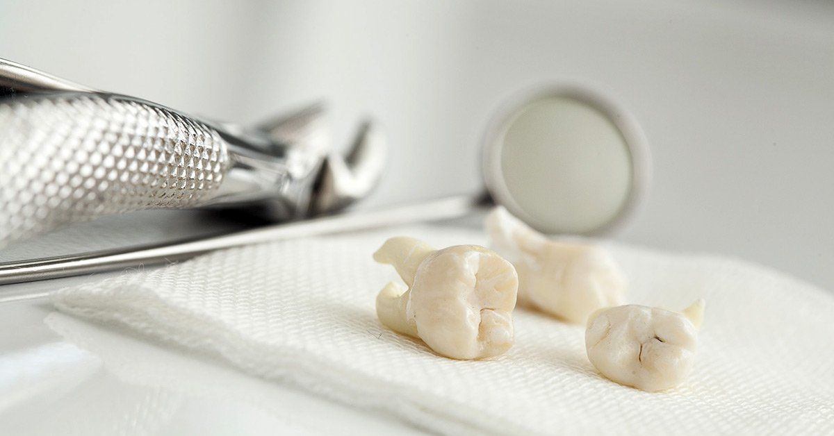 what to eat after a tooth extraction