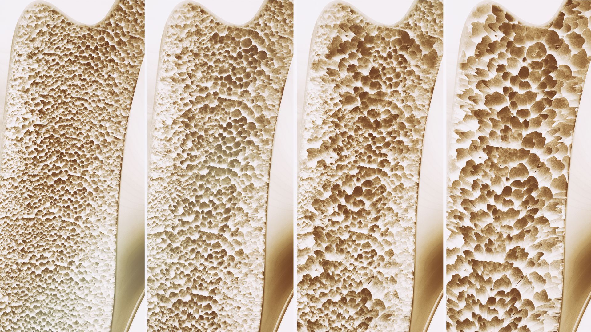 A close up of four different types of bone