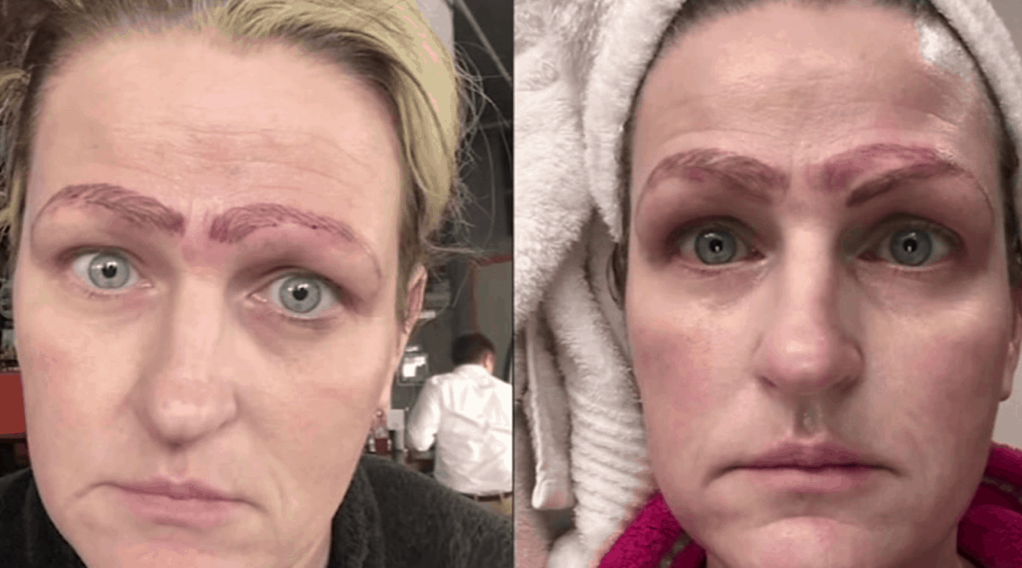 Botched bad Microblading