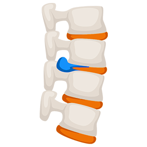 Medicina para el dolor de espalda