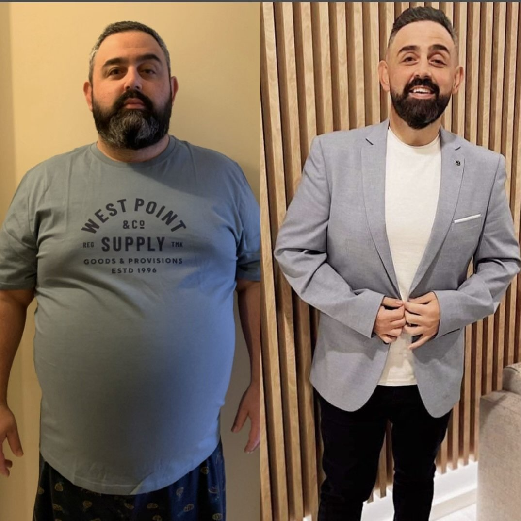 weight loss before and after