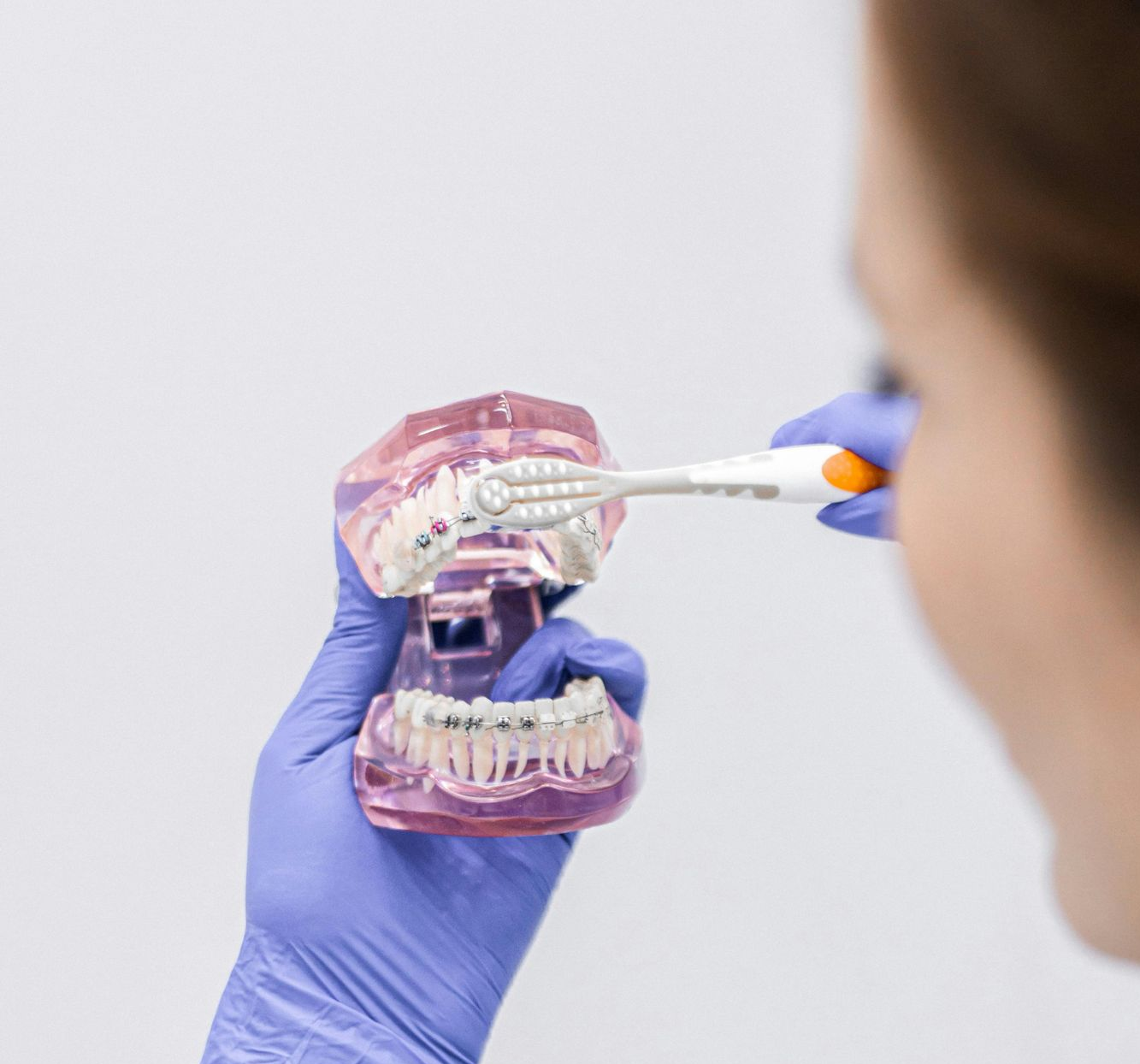 Gloved hand using a toothbrush on a dental model with pink gums and clear braces