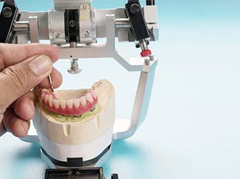 Dental Implant — Palmdale, CA — Posada Dental Practice