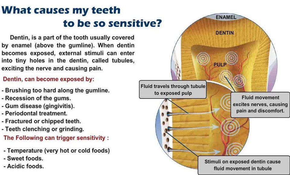 Sensitive Teeth — Palmdale, CA — Posada Dental Practice