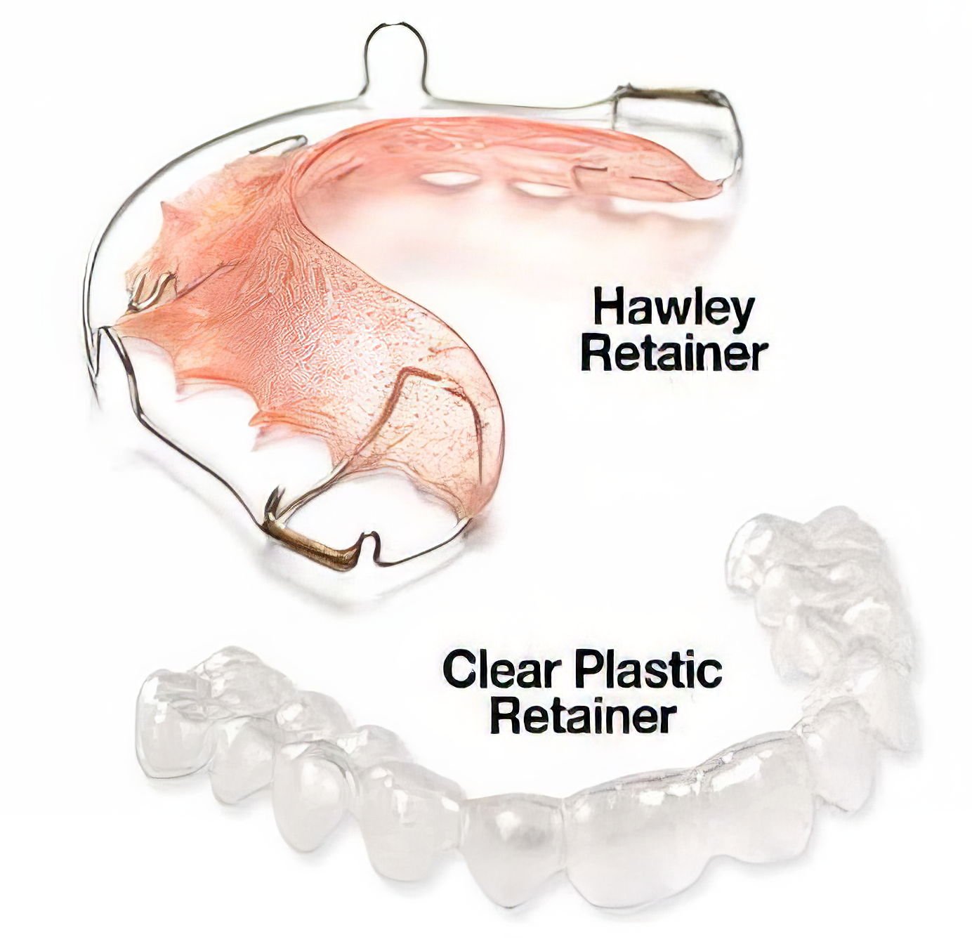 Two dental retainers: a pink Hawley and a clear plastic version.