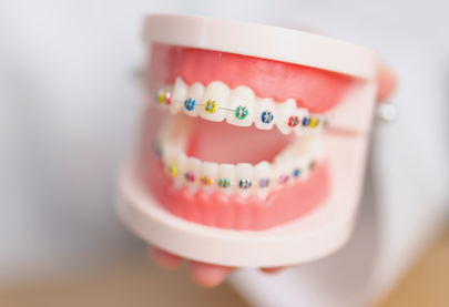 A person is holding a model of teeth with braces.