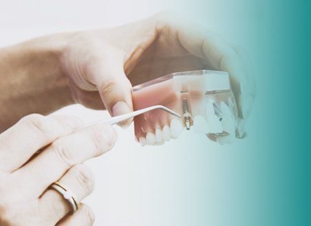 Complex Dentistry in Bathurst, NSW