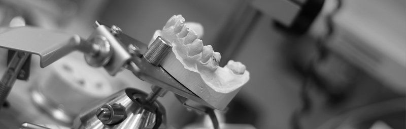 Ein Schwarzweißfoto eines Zahnmodells der Zähne einer Person.