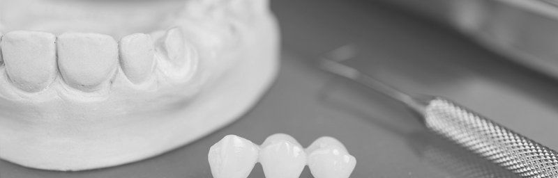 Ein Schwarzweißfoto eines Modells von Zähnen und zahnärztlichen Instrumenten.