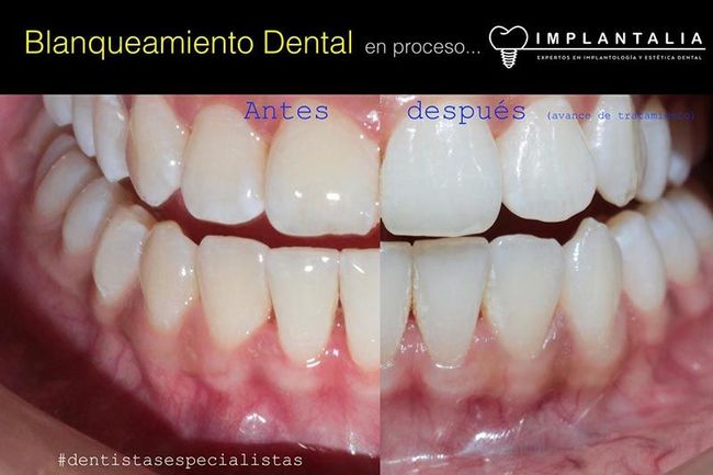 IMPLANTOLOGÍA Y ESTÉTICA DENTAL