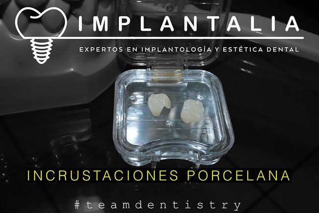 IMPLANTALIA