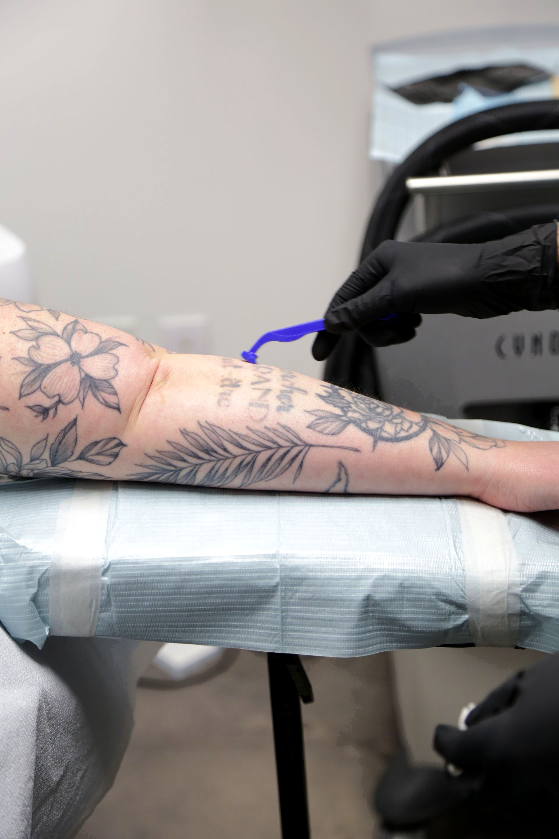 Arm with floral tattoos on a table, preparing for laser tattoo removal by a gloved hand holding a tool.