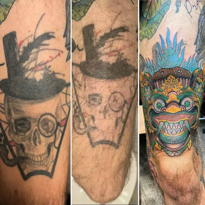 Tattoo cover-up process: original skull design, faded version, and colorful dragon/mask design covering the original.