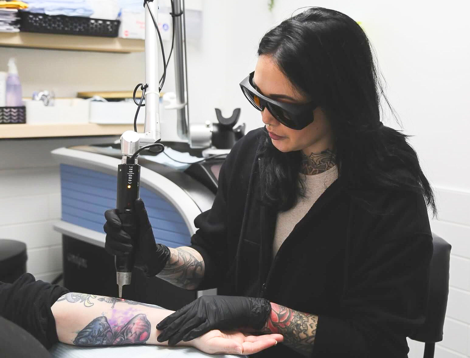 Person using a laser to remove a tattoo on a client's arm, wearing eye protection and gloves, in a medical setting.