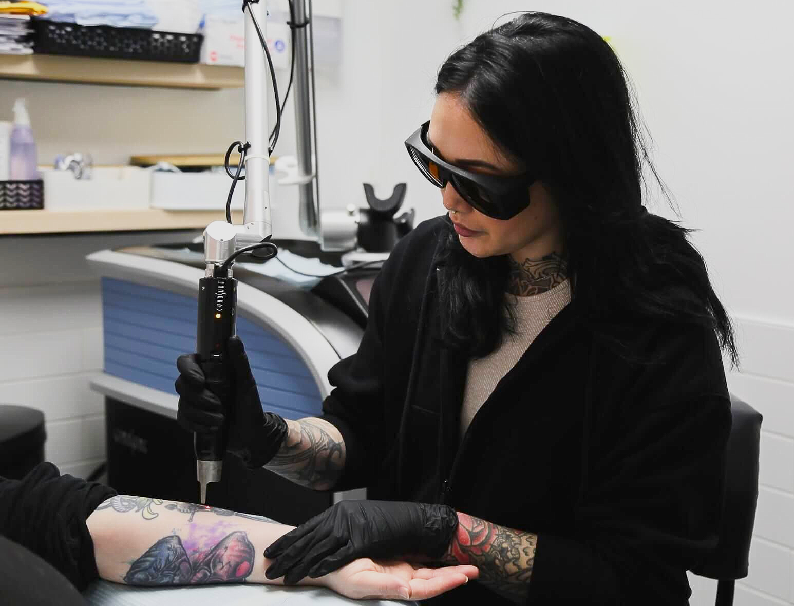 Person using a laser to remove a tattoo on a client's arm, wearing eye protection and gloves, in a medical setting.