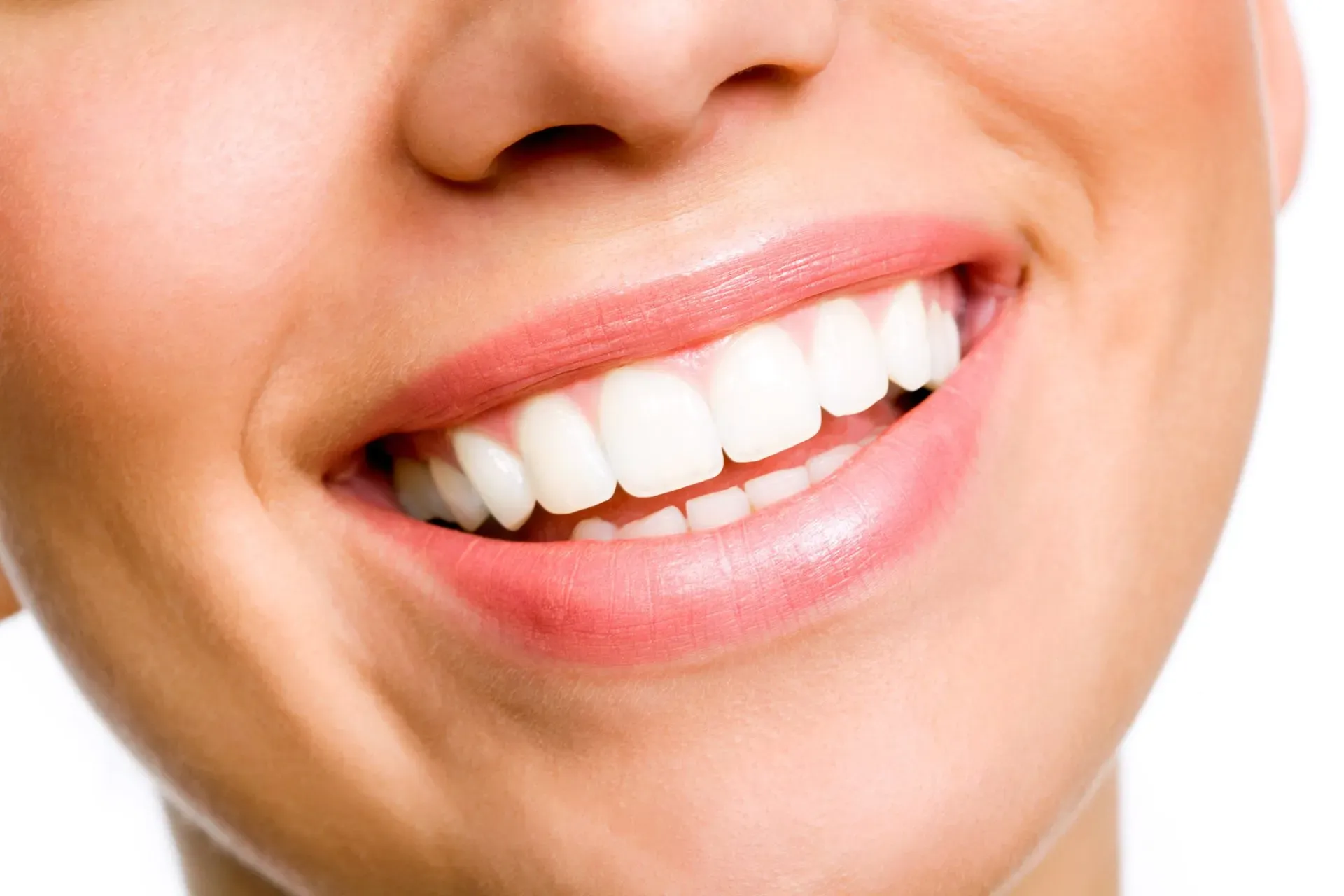 Smiling Young Woman With White Teeth — Columbia, SC — University Dental P.A.