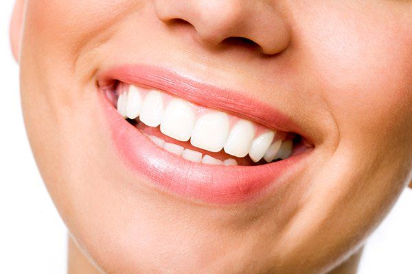 Teeth Whitening — Columbia, SC — University Dental PA