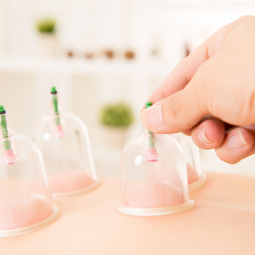 Everything You Need to Know About Dry Cupping