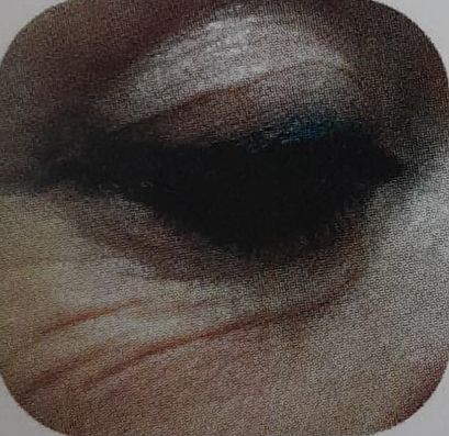 Ringiovanimento Periorbiculare