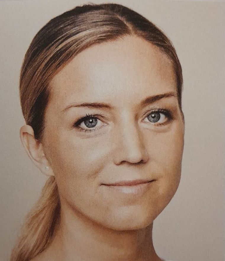 filler solco lacrimale