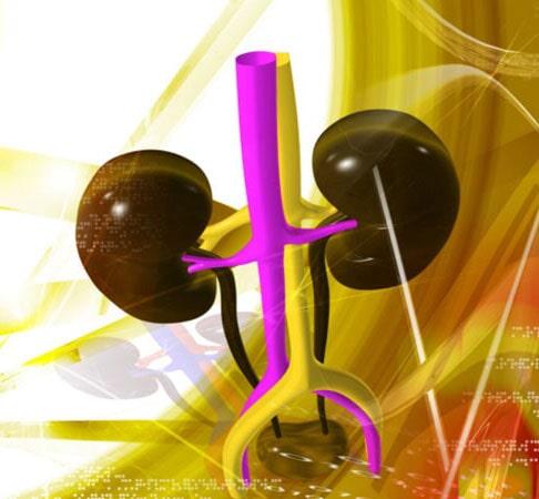 DR. ÓSCAR MANUEL SAUCEDO LUQUE - Cálculos renales, uretrales, vesicales