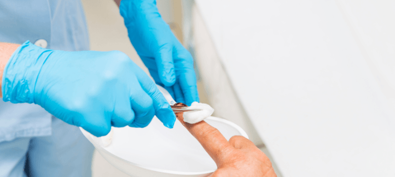 Wound Care