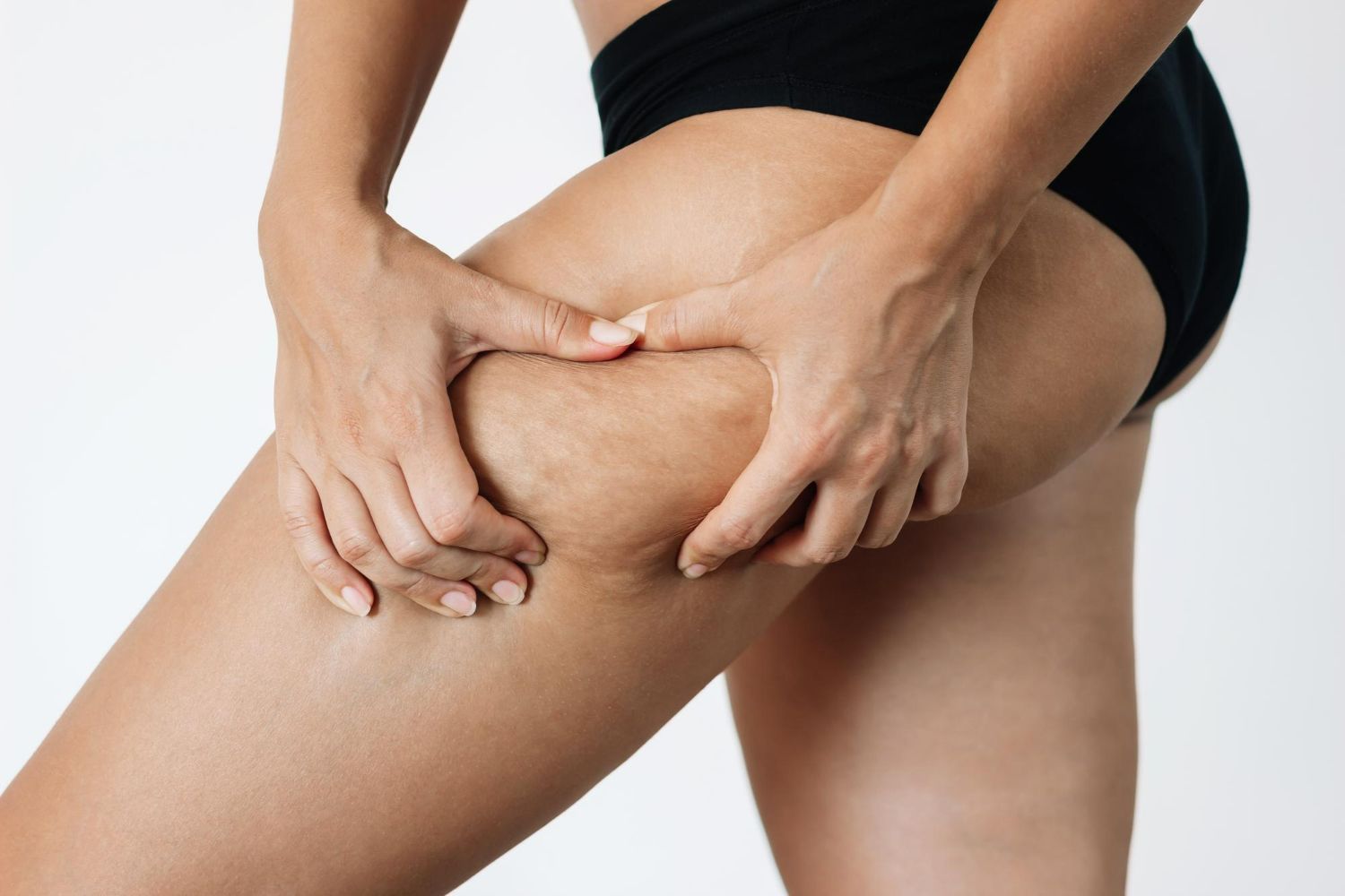 Person holding and squeezing their thigh, showing prominent cellulite.