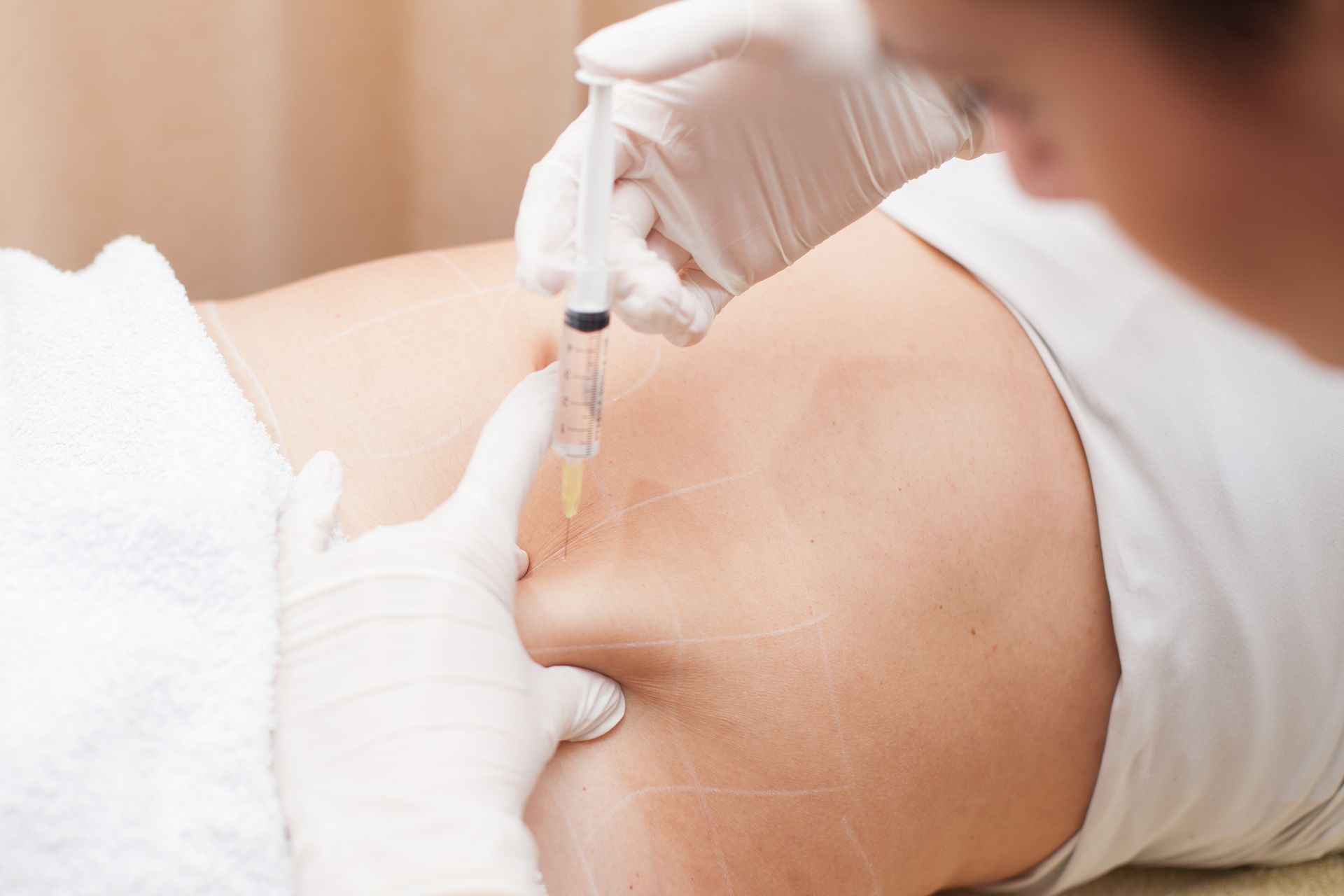 A woman is getting an injection in her back.
