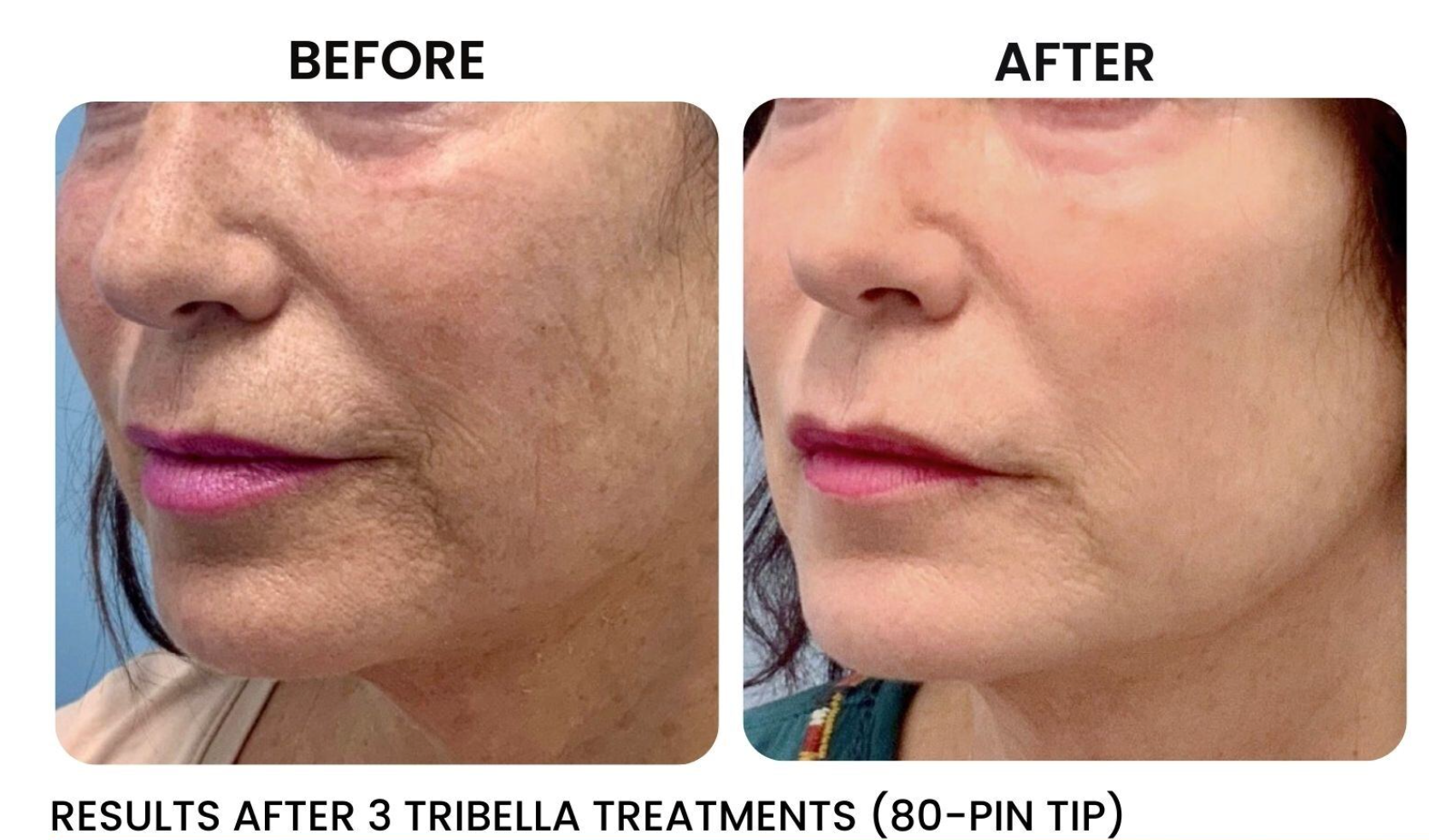 A before and after photo of a woman 's face