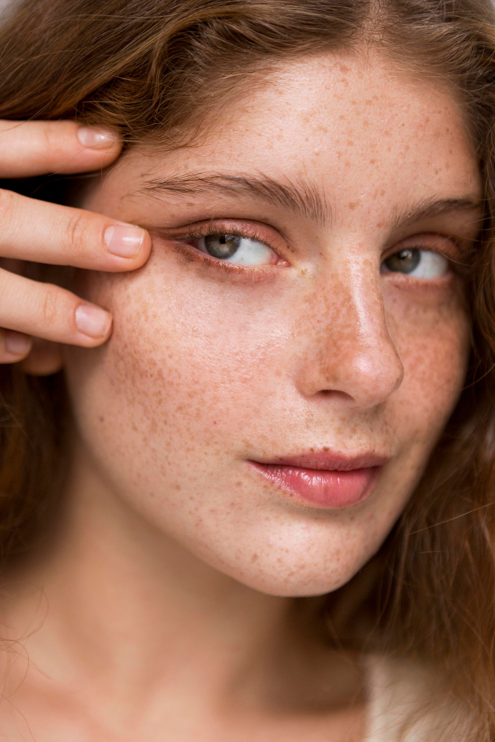 A woman with freckles is touching her face with her hand.