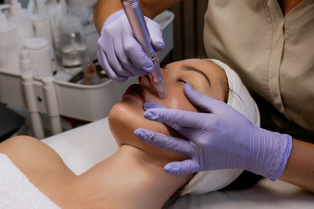 Person receiving a microneedling treatment on the face. A gloved hand uses a pen-like device near the face.