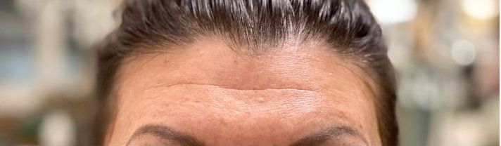 Nahaufnahme von Stirn und Augen einer Person mit zurückgekämmtem Haar, verschwommener Innenraum-Hintergrund