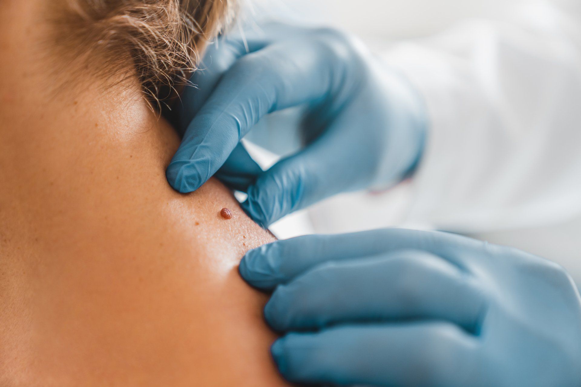 Dermatologist Examining Patient — Hastings, NE — Adams County Chiropractic