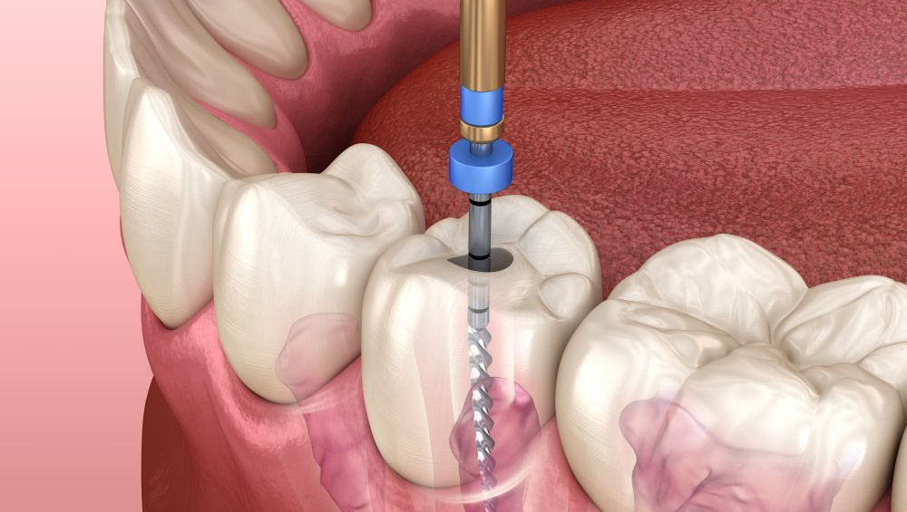 Endodontija