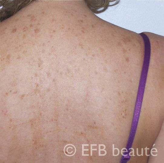 A close up of a woman 's back 